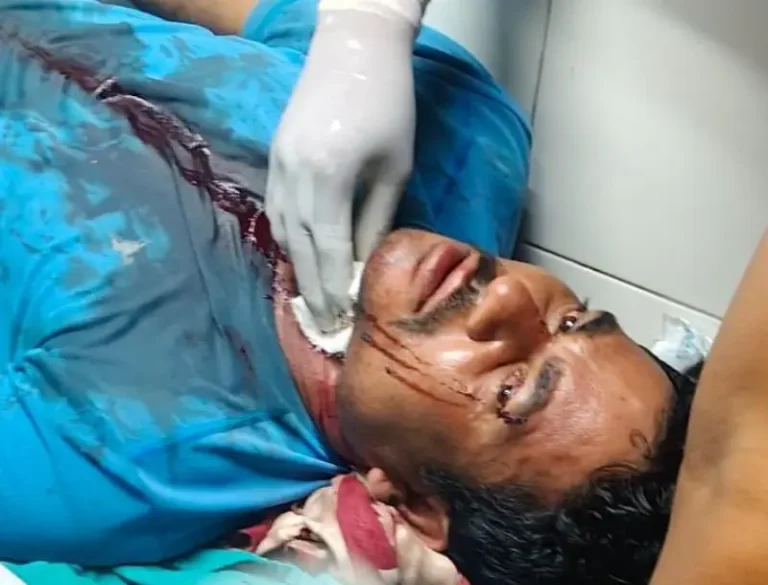 मनसर-माईन में खूनी खेल ! गलेपे किया ब्लेडसे वार