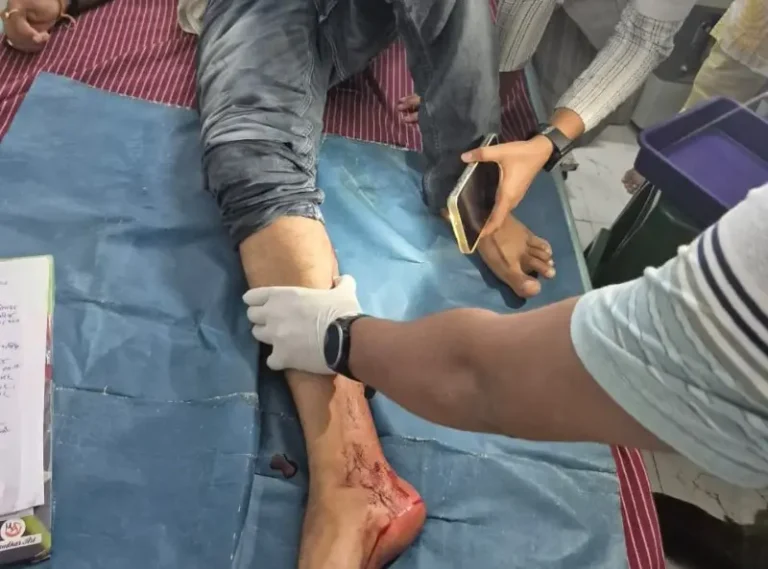 सराफा व्यापारी पर फायरिंग, नहीं मिला आरोपियों का सुराग